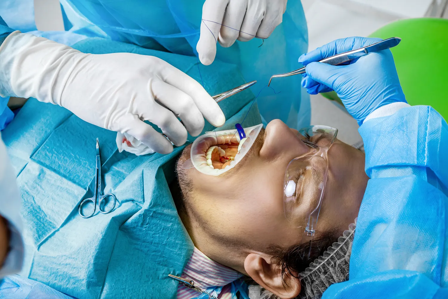 Co to jest e recepta?