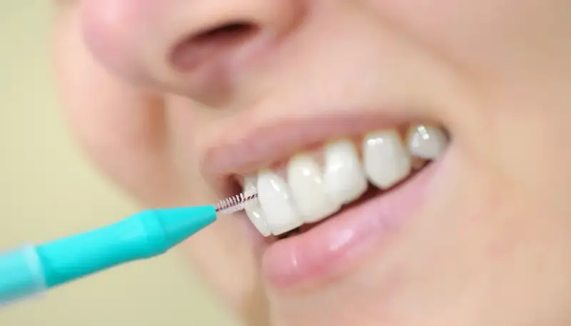 Leczenie kanałowe co to?