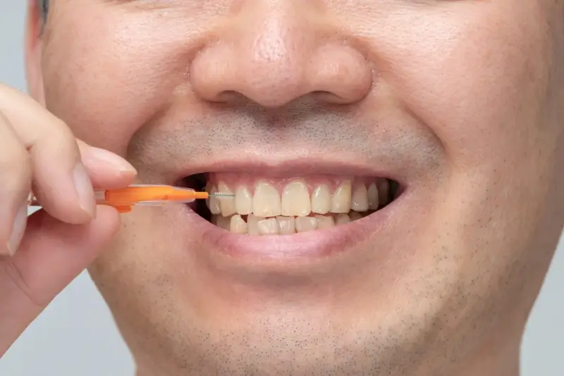 Rodzaje implantów dentystycznych